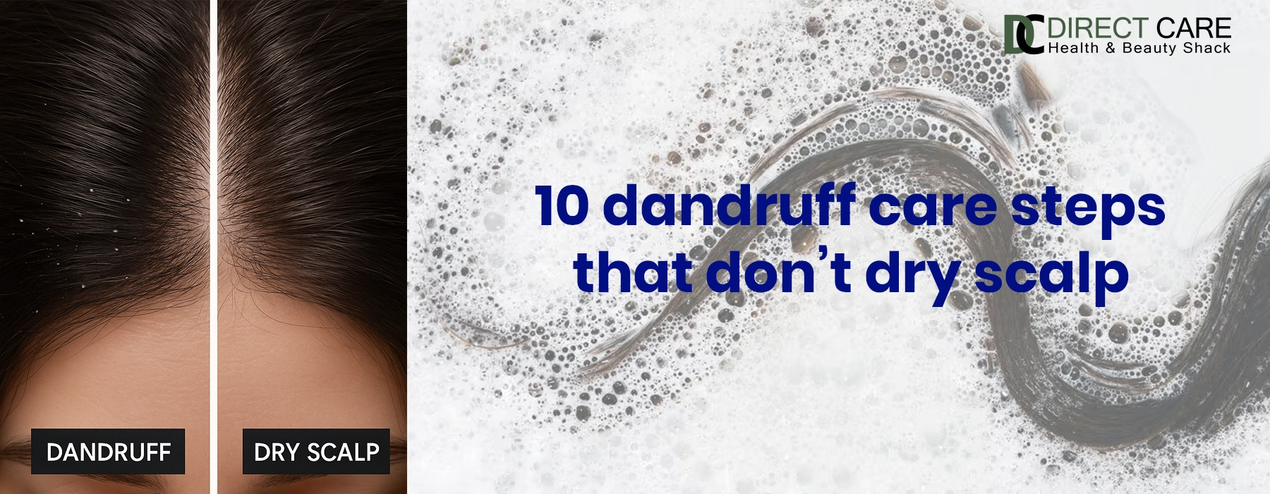 10 Dandruff Care Steps That Don’t Dry Scalp